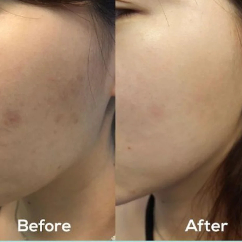 ClearGlo Beauty™ Dark Spot Correcting Glow Serum