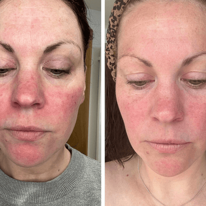 ClearGlo Beauty™ Premium Aura Glo Mask