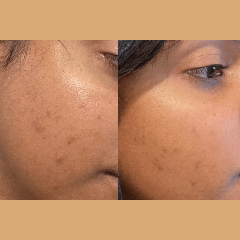 ClearGlo Beauty™ Glo Travel Wand