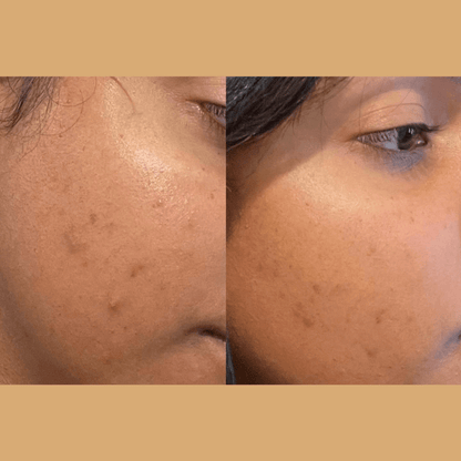 ClearGlo Beauty™ Glo Travel Wand