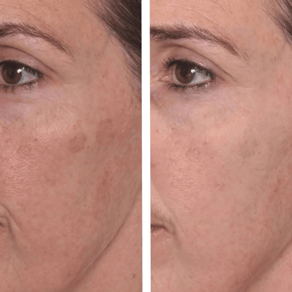 ClearGlo Beauty™ Dark Spot Correcting Glow Serum